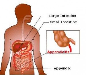 Appendix Laparo Scopic Surgeon Mumbai